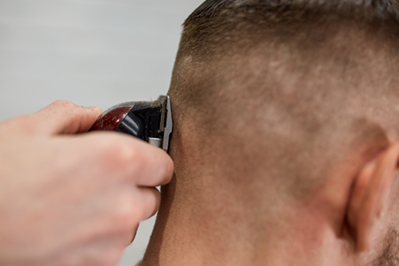 Máquina cortando el cabello en la zona donante para injerto capilar